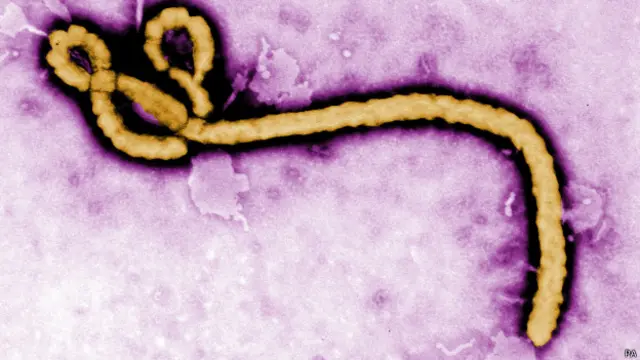 Virus Ebola tidak menular lewat udara namun dapat menular melalui cairan tubuh. 