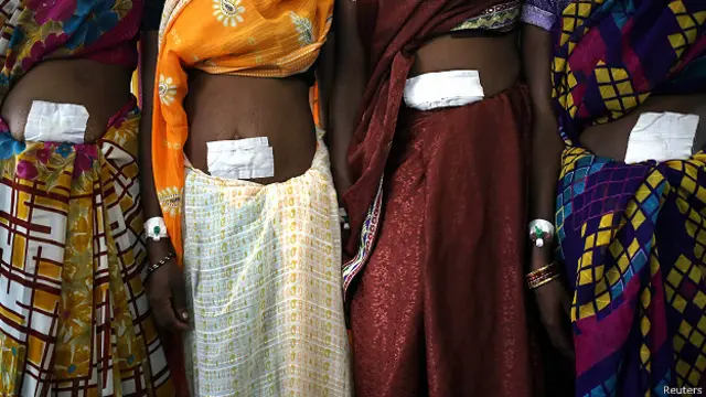 اس سے قبل ڈاکٹر نے بی بی سی کو بتایا تھا کہ وہ ایک دن میں اس سے زیادہ آپریشن بھی کر چکے ہیں