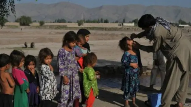 پاکستان د نړۍ یو له هغو دریو هېوادونو نه دی چې د ګوزڼ یا پولیو ناروغي اوس هم په کې شتون لري.