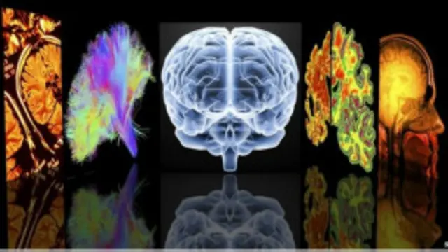 Perdida de la Memoria