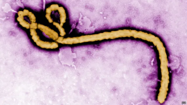 ebola
