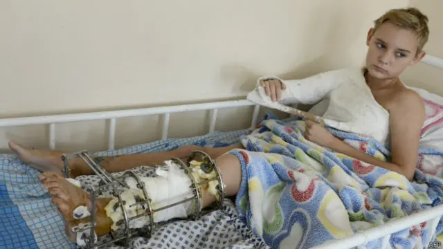 Поранений хлопчик