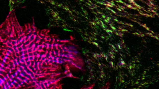 خلل في بروتين الفا اكتينين يتسبب في فقدان العضلة قدرتها على التقلص