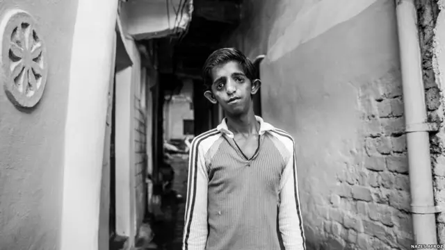 පහළොස් වියැති අසීම් අන්සාරි මුහුණේ අස්ථි ව්යාකුල තත්වයක් සහිතව උපන් දරුවෙකි. ඊට අමතරව ඔහු නිධන්ගත රෝග තත්වයකින් පෙළන අතර නිරන්තරයෙන් නාසයෙන් ලේ ගැලීමට මුහුණ දෙයි. රෝගී තත්වය හේතුවෙන් පාසල් යාම නවතා ඇති අසීම් සිය පවුලට උපකාර පිණිස ලී කම්හලක සේවය කරයි.