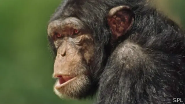 एचआईवी संक्रमण