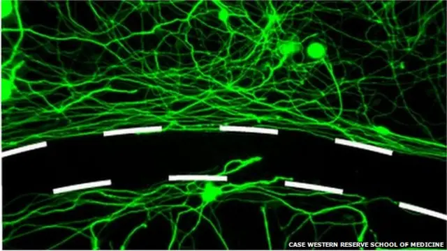 Crédito: Case Western Reserve School of Medicine