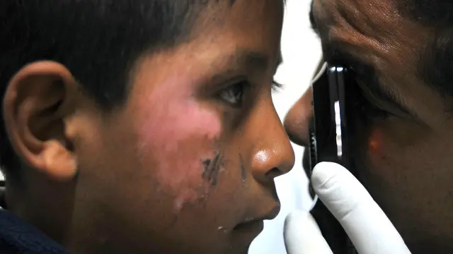 ریاست کے وزیر صحت کا کہنا ہے کہ غیر سرکاری ادارے نے کیمپ لگانے کے لیے حکومت سے اجازت نہیں لی تھی