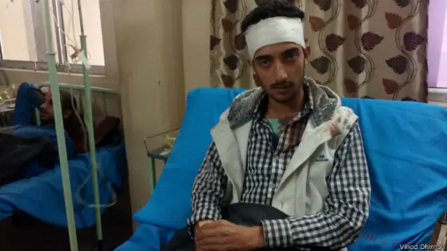 پولیس کا کہنا ہے کہ چار کشمیری طلبہ زخمی ہوئے ہیں جبکہ طلبہ کا کہنا ہے کہ کم از کم دس زخمی ہوئے ہیں