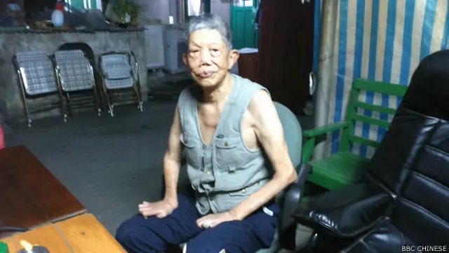 將近60年前被強制送到樂生療養院收容的黃文章（BBC中文網照片）