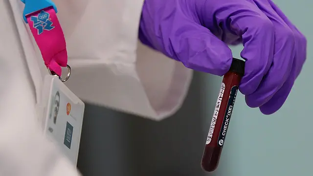 آئی اے اے ایف کا کہنا ہے کہ وہ ڈوپنگ روکنے کے لیے نئی نئی تراکیب کے استعمال میں پیش پیش رہی ہے