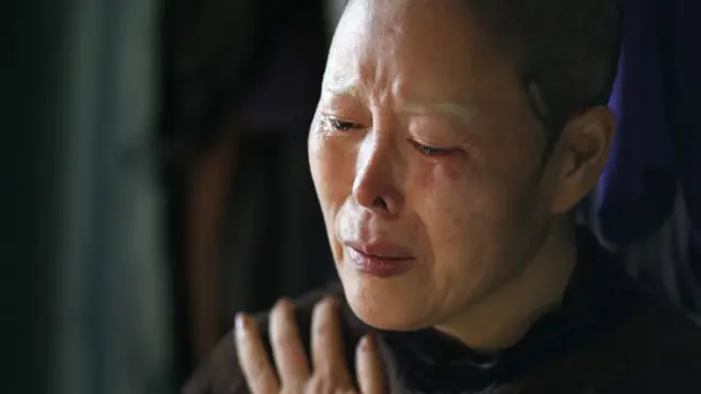 مگر اب لوگوں میں ایک ردعمل پایا جاتا ہے اور توقعات کے مطابق نتائج نہ حاصل پر مریض بڑی تعداد میں ڈاکٹروں پر مقدمات کر رہے ہیں