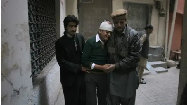 پوځ وايي په برید کې ۱۲۵ کسان ټپیان شوي.