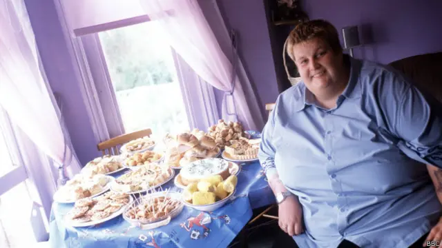 Chris Leopard, paciente con Prader-Willi