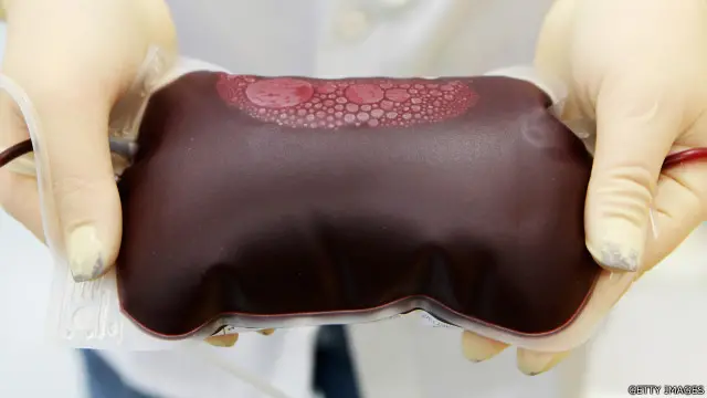 Larangan bagi gay untuk mendonorkan darah dinilai kalangan aktivis "tidak beralasan".