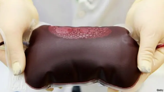 يقول نشطاء إن حظر تبرع المثليين بالدم يعد تمييزا ضد المثليين من الرجال ويعزز الصور النمطية السلبية.