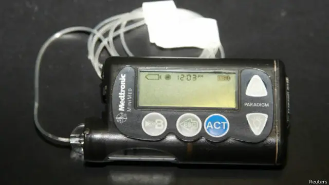 پمپ انسولین تحولی بزرگی در زندگی مبتلایان به دیابت نوع اول ایجاد می‌کند