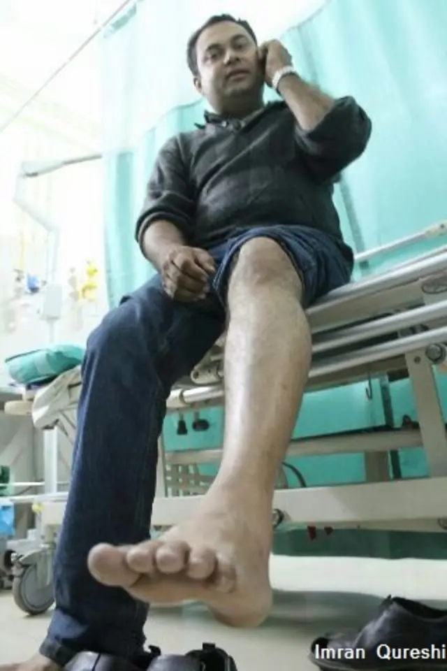 धमाके में घायल होने वालों में विनय भी शामिल हैं