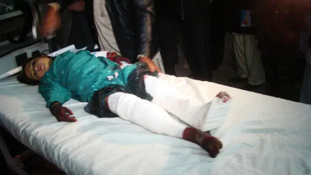 طفلة أصيبت في الحادث تعالج بمستشفى في إقليم هلمند. 