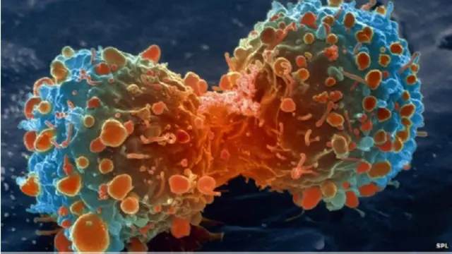 कैंसर कोशिका