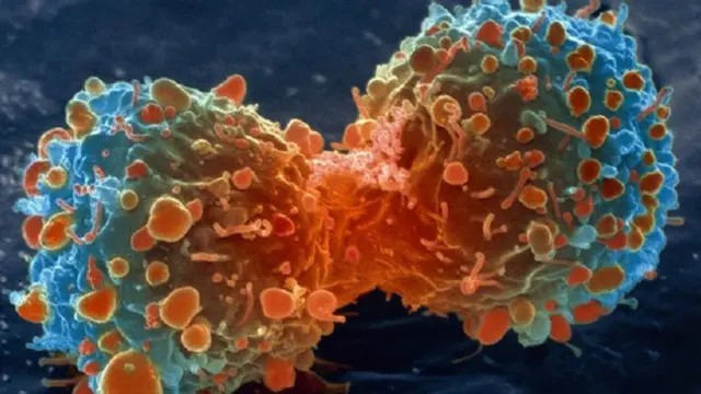 د سګریټ څکولو په څېر د ناوړه عادتونو پرېښودل د سرطان په مخنیوي کې ګټور ګڼل شوي