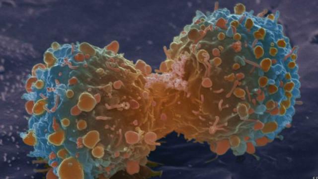 霍普金斯大学的研究人员相信组织细胞再生时突变可能是导致癌症的原因。 