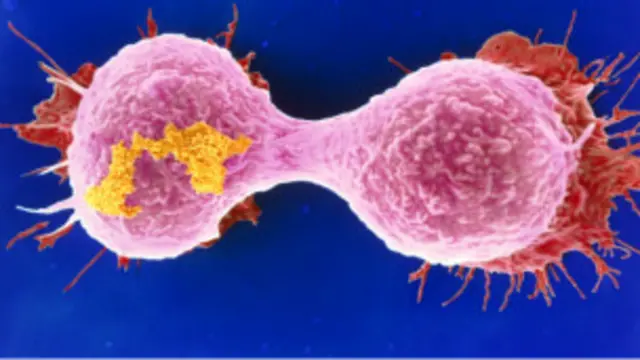 क्यान्सरका धेरै विरामी रोग अन्तिम चरणमा पुगेपछि अस्पताल पुग्ने गरेको बताइन्छ