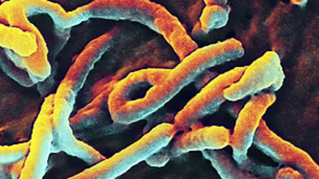 इबोला वायरस