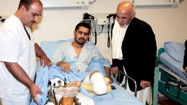 ولسمشر غني د کابل پوځي روغتون کې له ناروغانو او ډاکټرانو سره وکتل