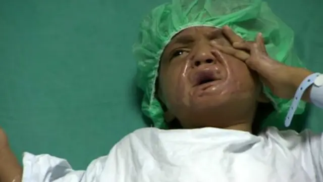 Qamar Qadour telah menjalani lebih dari 20 kali operasi.