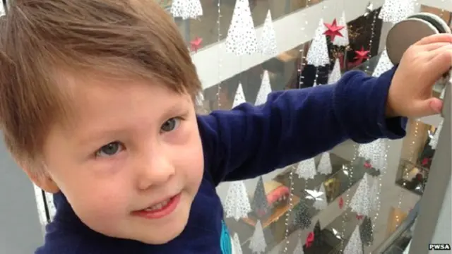 प्रेडर विली सिंड्रोम