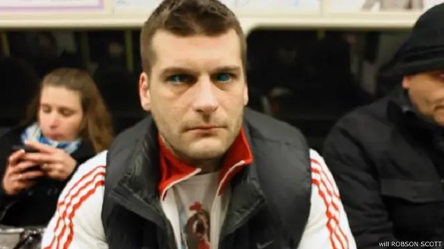 مغنى الراب بوبيك بدأ يشعر بحساسية شديدة في العين جعلته غير قادر على النوم بعدما عمل وشما لمقلة العين