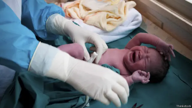 Parto por cesariana (Foto: Thinkstock)