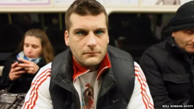 Mwanamuziki huyu alisema alihisi macho yake yalikuwa yanachomeka baada ya kufanyiwa tatoo ya jicho