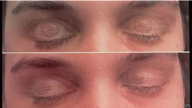 Фаза быстрого сна