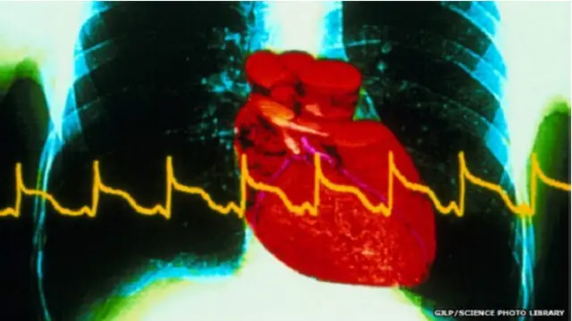 دل کا دورہ طبی ایمرجنسی ہوتی ہے اور اس کی قبل از وقت تشخیص سے مریض کی زندگی بچ سکتی ہے