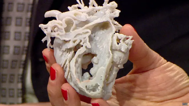 Coração artificial / Crédito: BBC