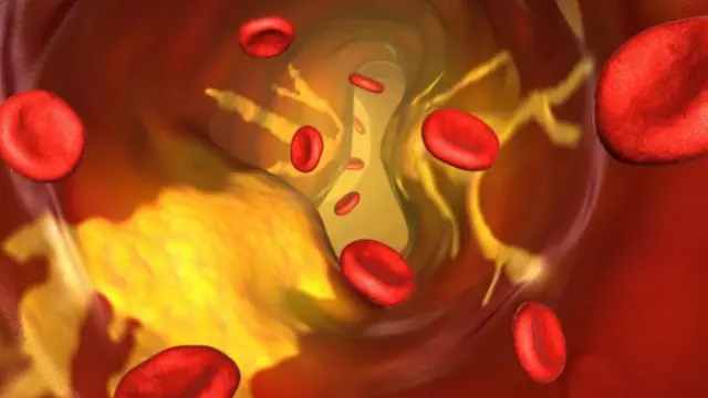 نسبة الكوليسترول