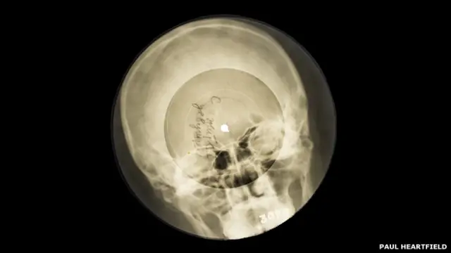 Пластинка, записанная на рентгеновском снимке