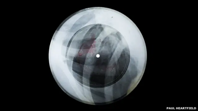 Пластинка, записанная на рентгеновском снимке