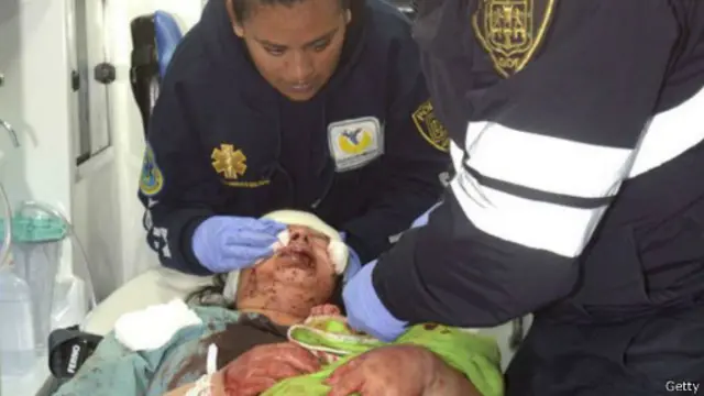 دھماکے کے بعد درجنوں لوگ زیر علاج ہیں