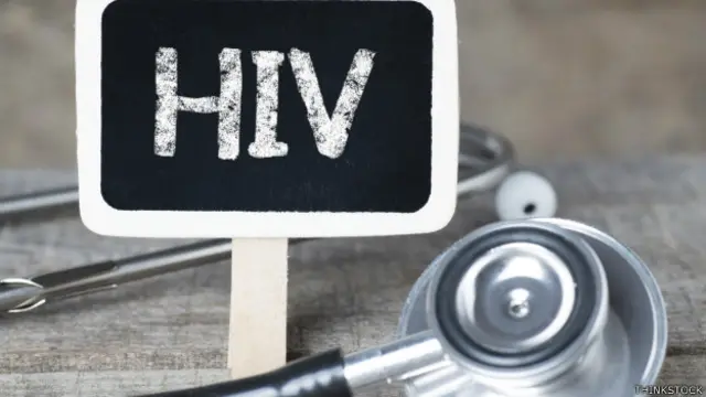 El organismo de la ONU recomienda derogar la obligación legal de revelar el propio estado serológico o el de otros, en el caso de trabajadores sanitarios, vigente en algunos países.