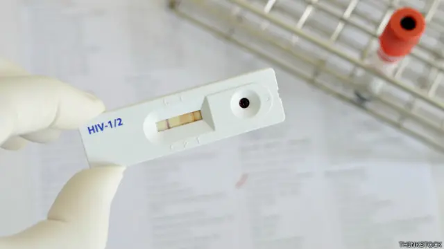 Onusida dice que la ley penal debe aplicarse cuando la persona conoce su estado serológico positivo y actúa con intención de transmitirlo.