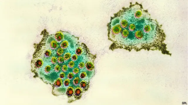 Norovirus.