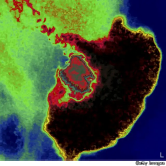 تومور معده در عکسبرداری