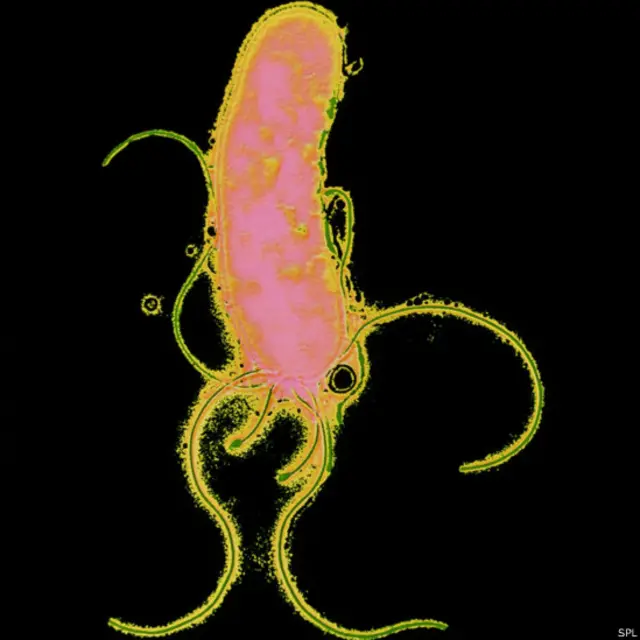 هلیکوباکتر پایلوری