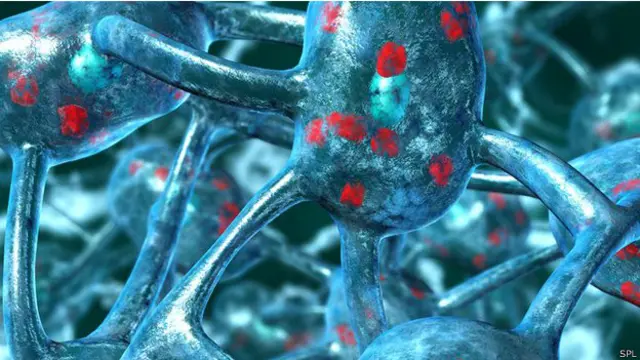 Manos de un paciente con la enfermedad de Parkinson