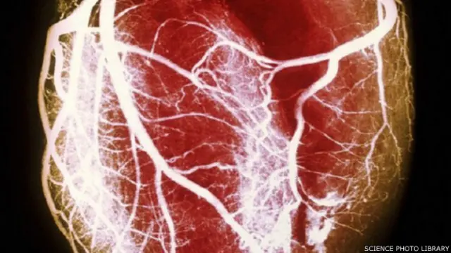 دل کی صحت کے لیے صاف و شفاف شرائین کا اہم کردار ہے