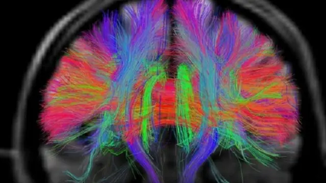 قد تكن تقنية البعد الثالث سببا في اكتشاف الأسباب الحقيقية لأمراض القلب