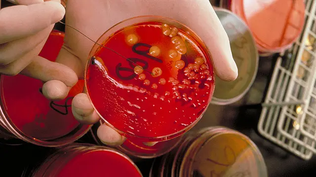 ایڈز اور ایچ آئی وی کی ویکسین اور ادویات کے آنے سے اب یہ ایک ایسا مرض بن گئی ہے جو ساری عمر کا انفیکشن تو ہے مگر موت کا فوری پروانہ نہیں