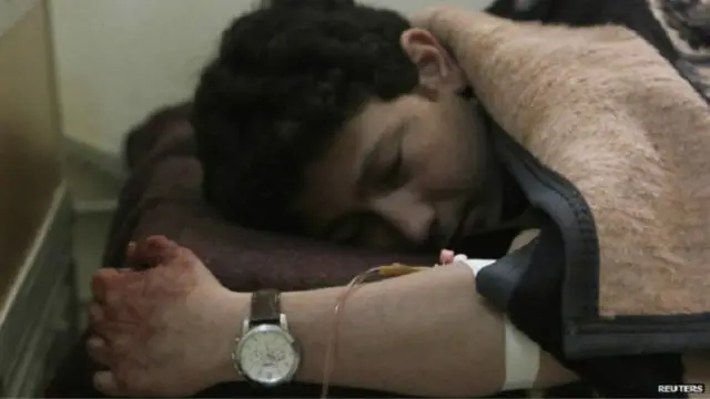 تعرض كثير من المدنيين في حلب إلى الإصابة منذ منتصف 2012.